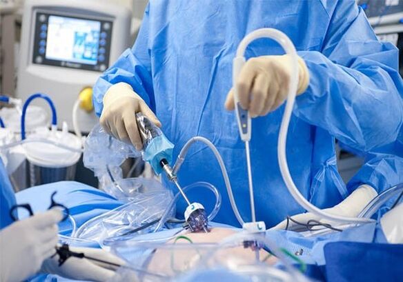 tratamentul chirurgical al varicelor pelvine